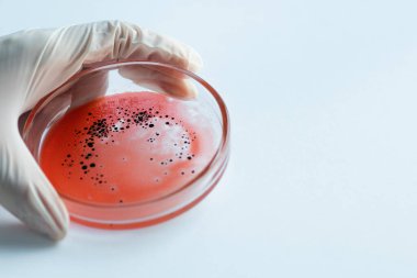 Virüs ve bakteri araştırması, araştırmacının elinde bir Petri kabı var..