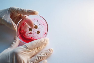 Virüs ve bakteri araştırması, araştırmacının elinde bir Petri kabı var..