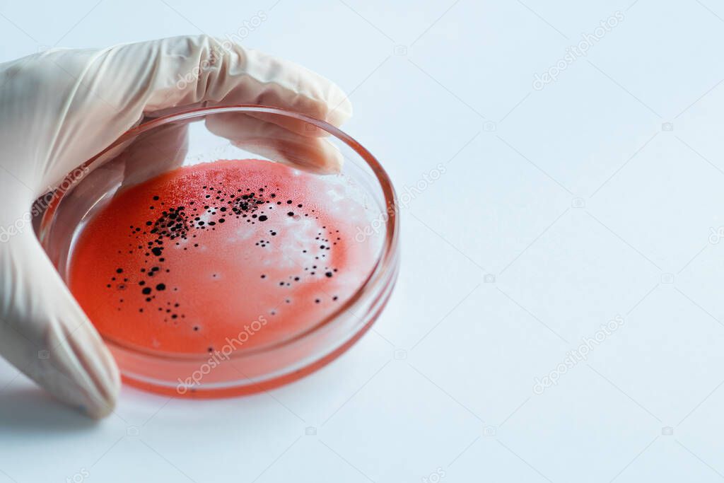 Research of viruses and bacteria, researcher holds a Petri dish with a sample.