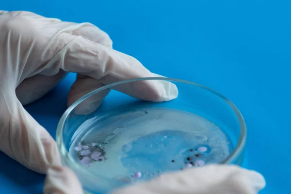 Investigación de virus y bacterias, investigador sostiene una placa de Petri con una muestra. — Foto de Stock