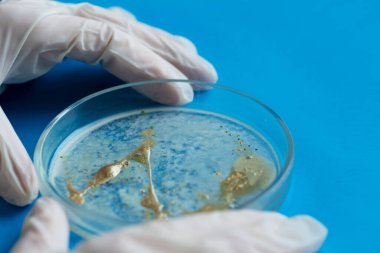 Biyolog ya da virolog bir Petri kabını elinde tutuyor..