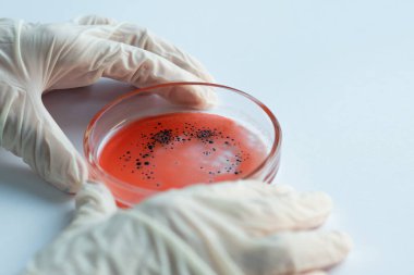 Salgın ve küresel virüs saldırısı konsepti. Laboratuvar teknisyeni ya da araştırmacı bir Petri kabını elinde tutuyor.