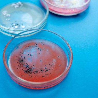 Salgın ve küresel virüs saldırısı konsepti. Laboratuvar farklı örnekler test ediyor.