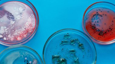 Salgın ve küresel virüs saldırısı konsepti. Laboratuvar farklı örnekler test ediyor.