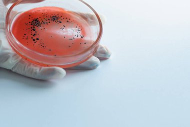 Salgın ve küresel virüs saldırısı konsepti. Laboratuvar teknisyeni ya da araştırmacı bir Petri kabını elinde tutuyor.