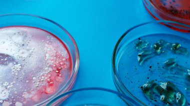 Petri kabındaki virüsler ve bakteriler, laboratuvardaki çeşitli analizler. Viroloji ve virüs araştırması, konsept.