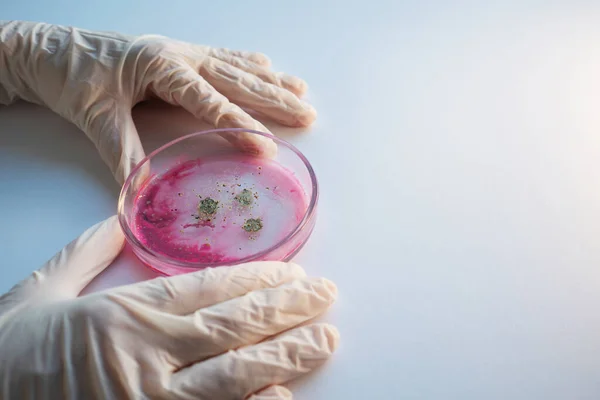 epidemic and the global virus attack concept. lab technician or researcher holds a Petri dish with a sample