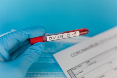 Doktor elinde kan tüpü var. Cov Coronavirus hastanede pozitif çıktı. Yeni hızla yayılan Coronavirüs, dünya salgını.