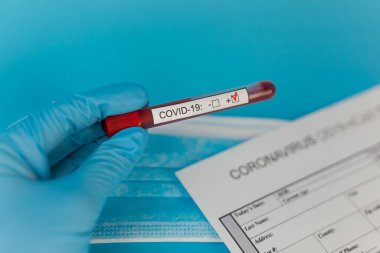 Doktor elinde kan tüpü var. Cov Coronavirus hastanede pozitif çıktı. Yeni hızla yayılan Coronavirüs, dünya salgını.