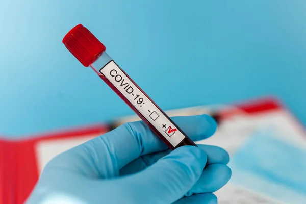 Blodprovsrör Hos Läkare Hand Mers Cov Coronavirus Testa Positiv Etikett — Stockfoto