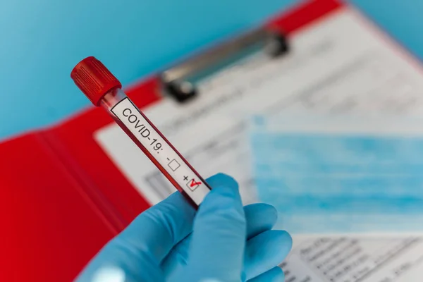 Blodprovsrör Hos Läkare Hand Mers Cov Coronavirus Testa Positiv Etikett — Stockfoto