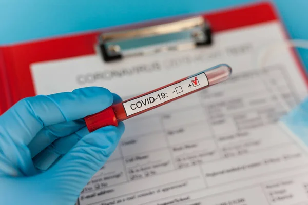 Rurka Wynikami Badania Krwi Lekarza Dodatnim Wynikiem Testu Koronawirusowego Szpitalu — Zdjęcie stockowe