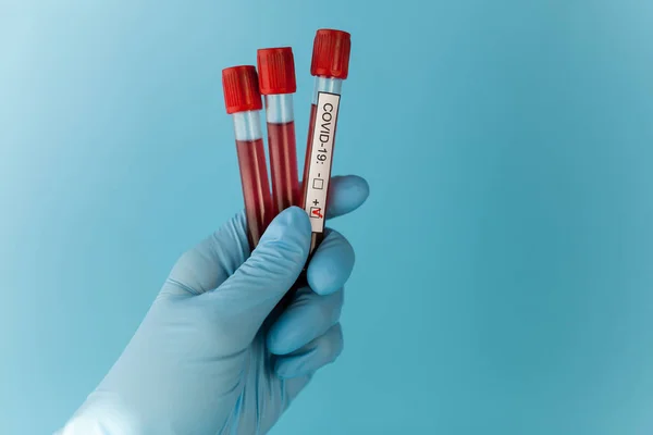 Nur Wenige Blutkonservenröhrchen Der Hand Des Arztes Weisen Krankenhaus Ein — Stockfoto