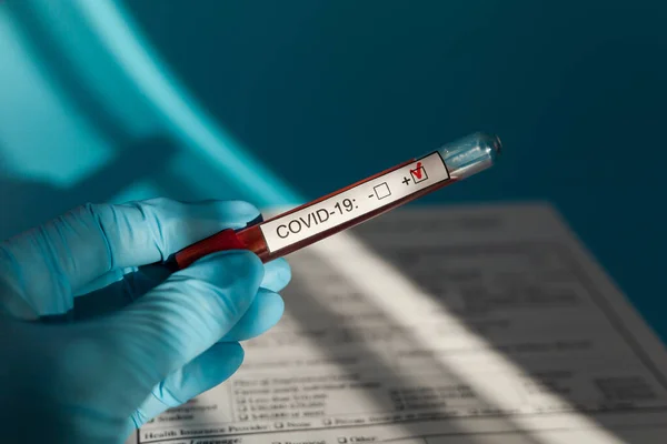 Tubo Sangue Médico Mão Mers Cov Coronavirus Teste Positivo Rótulo — Fotografia de Stock