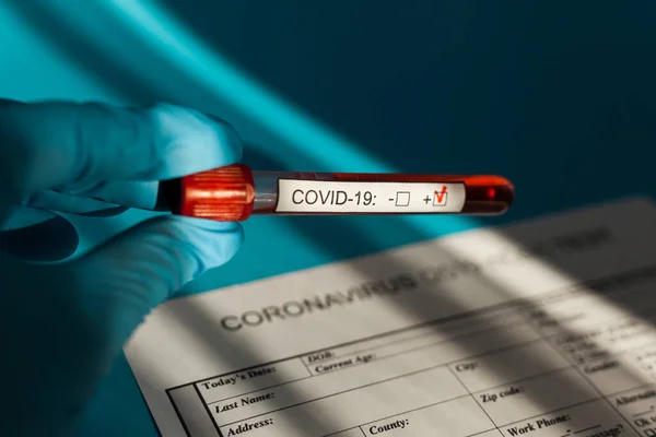 Blutkonservenröhrchen Der Hand Des Arztes Cov Coronavirus Test Positiv Krankenhaus — Stockfoto