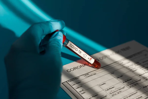 Blutkonservenröhrchen Der Hand Des Arztes Cov Coronavirus Test Positiv Krankenhaus — Stockfoto