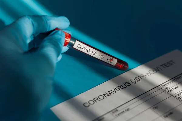 Blutkonservenröhrchen Der Hand Des Arztes Cov Coronavirus Test Positiv Krankenhaus — Stockfoto