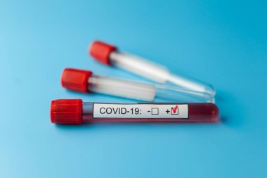 Yeni hızla yayılan Coronavirus salgını için mavi doktor masasında kan testi tüpleri var..