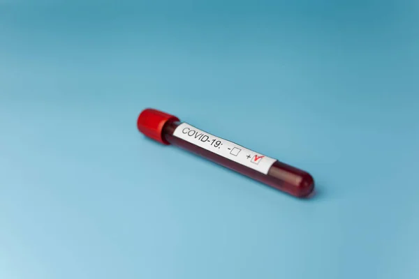 Blutuntersuchungsröhrchen Auf Dem Blauen Arzttisch Für Das Neue Sich Rasch — Stockfoto