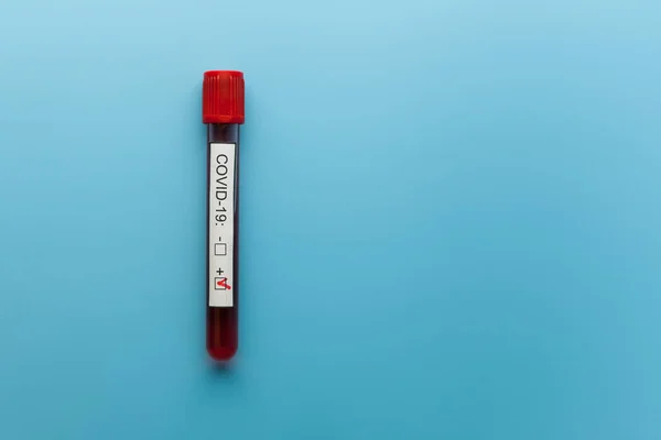 蓝色医生桌上的血液检测结果管 用于新的快速传播的大肠癌 世界大流行 — 图库照片