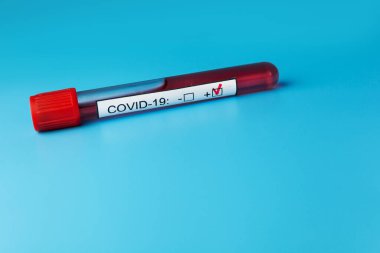 Yeni hızla yayılan Coronavirus salgını için mavi doktor masasında kan testi tüpü var..
