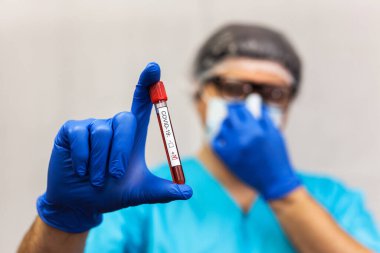 Maskeli laboratuvar teknisyeni Corona virüs testi için kan örneği tüpünü tutuyor. COVID 19.
