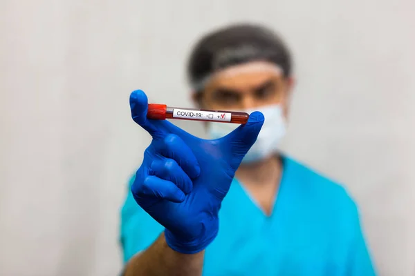 Técnico Laboratorio Asimiento Máscara Tubo Muestra Sangre Para Prueba Del — Foto de Stock
