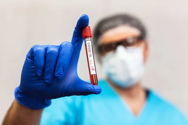 Technik Laboratoryjny Masce Trzymać Probówkę Krwi Badania Wirusa Korony Covid — Zdjęcie stockowe