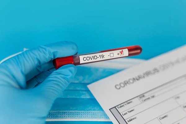 Blutkonservenröhrchen Der Hand Des Arztes Cov Coronavirus Test Positiv Krankenhaus — Stockfoto