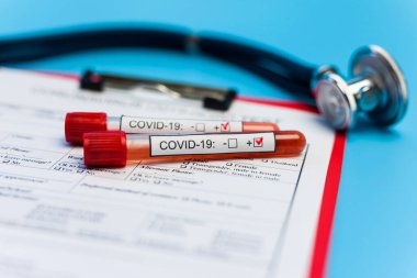 Salgın COVID 19, Coronavirus. Hiç kimse. Tıbbi malzemeler, testler, şişeler, steteskop, üzerinde notlar olan pano. Laboratuvar kavramı, yeni uyuşturucu ve aşıların geliştirilmesi