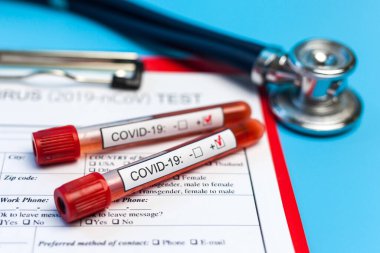Salgın COVID 19, Coronavirus. Hiç kimse. Tıbbi malzemeler, testler, şişeler, steteskop, üzerinde notlar olan pano. Laboratuvar kavramı, yeni uyuşturucu ve aşıların geliştirilmesi