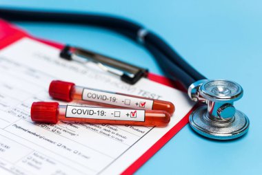 Salgın COVID 19, Coronavirus. Hiç kimse. Tıbbi malzemeler, testler, şişeler, steteskop, üzerinde notlar olan pano. Laboratuvar kavramı, yeni uyuşturucu ve aşıların geliştirilmesi