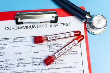 Salgın COVID 19, Coronavirus. Hiç kimse. Tıbbi malzemeler, testler, şişeler, steteskop, üzerinde notlar olan pano. Laboratuvar kavramı, yeni uyuşturucu ve aşıların geliştirilmesi