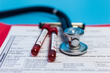 Salgın COVID 19, Coronavirus. Hiç kimse. Tıbbi malzemeler, testler, şişeler, steteskop, üzerinde notlar olan pano. Laboratuvar kavramı, yeni uyuşturucu ve aşıların geliştirilmesi