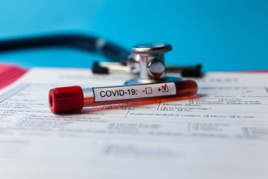Salgın COVID 19, Coronavirus. Hiç kimse. Tıbbi malzemeler, testler, şişeler, steteskop, üzerinde notlar olan pano. Laboratuvar kavramı, yeni uyuşturucu ve aşıların geliştirilmesi