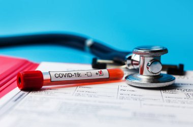 Salgın COVID 19, Coronavirus. Hiç kimse. Tıbbi malzemeler, testler, şişeler, steteskop, üzerinde notlar olan pano. Laboratuvar kavramı, yeni uyuşturucu ve aşıların geliştirilmesi