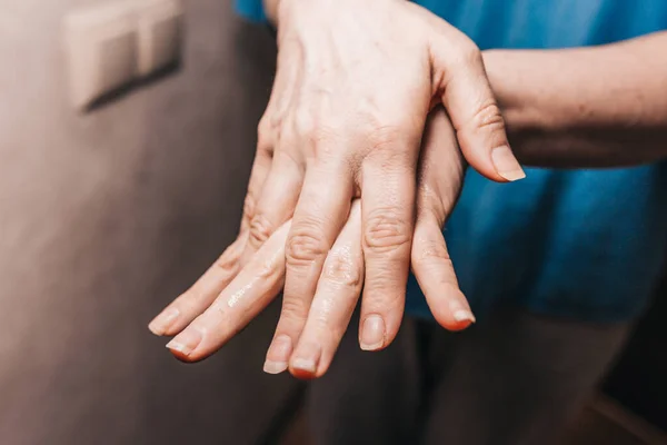 Moisturizing Skin Female Hands Maintaining Skin Smoothness Exposure Household Chemicals — Stock Photo, Image