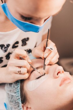 Kirpiklerin uzunluğu ve yoğunluğunun düzeltilmesi - yapay kirpiklerin oluşturulması için yapılan kozmetik bir operasyon