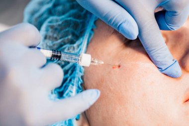 Contour düzeltme kırışıklıkları doldurmak ve doku hacmini iyileştirmek için yapılan bir prosedürdür - yakın çekim - doktor hastaya hyaluronik asit derisinin altına bir şırınga enjekte eder (dolgu maddesi).)