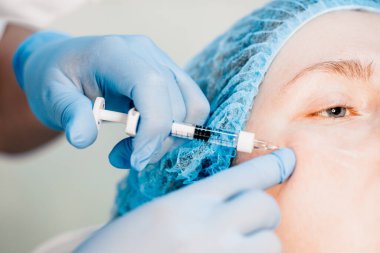 Elmacık kemiği hatları güvenli ve etkili bir işlemdir. Elmacık kemiklerinin şeklini çabucak düzeltmeye yardımcı olur. Ameliyat, acı ve uzun bir rehabilitasyon süreci olmadan yüzün şeklini daha net bir şekilde tanımlar.