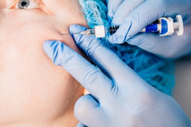 Contour Plastikleri - Hyaluronic asite dayanan cilt doldurma hazırlıklarının (dolguları) orta katmanlarına enjekte ederek enjeksiyon yenileme