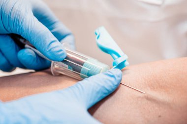 Kan testi gerekli bir teşhis aracıdır. Teşhisi mümkün olduğunca çabuk ya da doğru bir şekilde çürütmenizi sağlar.