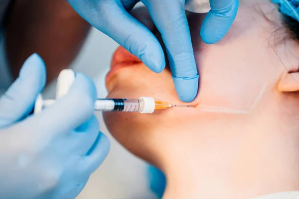 Contour correction kırışıklıkları doldurmak ve doku hacmini onarmak için bir prosedürdür - doktor çene bölgesinde hyaluronik asit enjekte eder