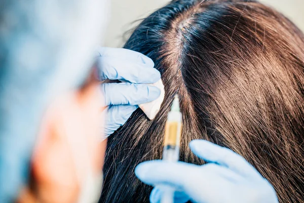 Plasmolifting of the scalp - in the case of the initial stages of baldness and to improve the condition of the hair