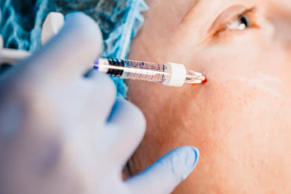 Injection into the face close up needle under the skin - cosmetology