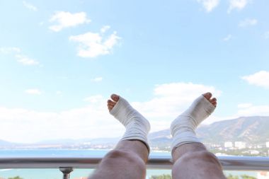 Alçı Bacağı kırık