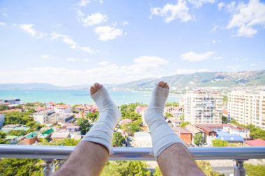 Alçı Bacağı kırık