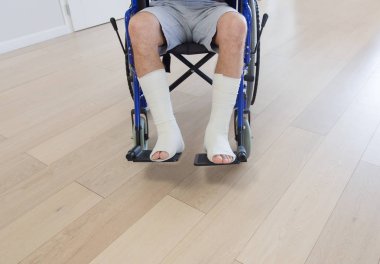 Alçı Bacağı kırık