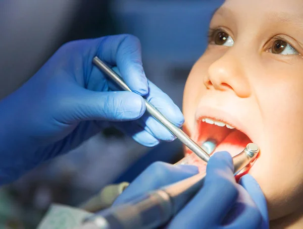 Niña en el dentista — Foto de Stock