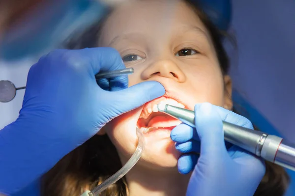 Κοριτσάκι στον οδοντίατρο. — Φωτογραφία Αρχείου